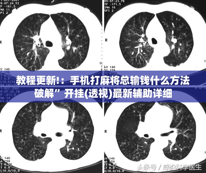 教程更新!：手机打麻将总输钱什么方法破解	”开挂(透视)最新辅助详细