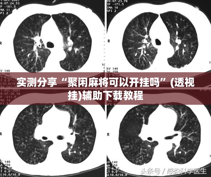 实测分享“聚闲麻将可以开挂吗	”(透视挂)辅助下载教程