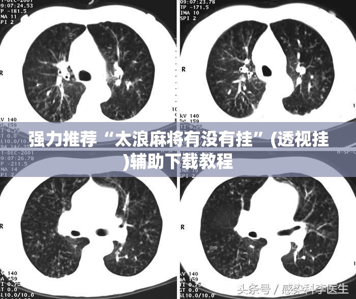强力推荐“太浪麻将有没有挂”(透视挂)辅助下载教程